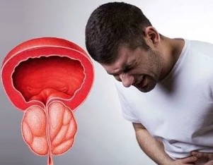 Симптомы хронического простатита у мужчин